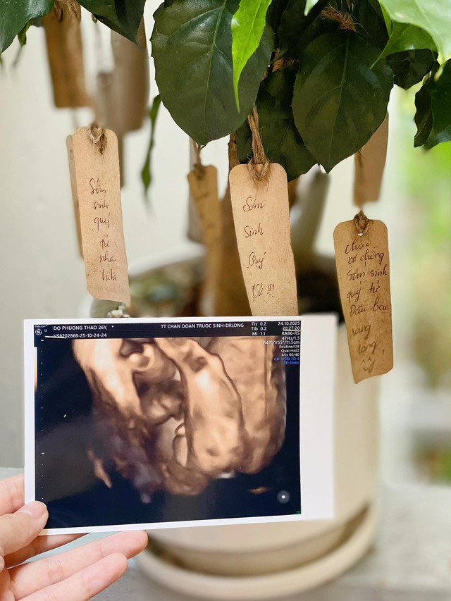 Sao nam Vbiz và vợ yêu 9 năm thông báo có con sau 7 tháng kết hôn- Ảnh 1. Hoàng Triều Dương hạnh phúc thông báo tin vui lên chức bố