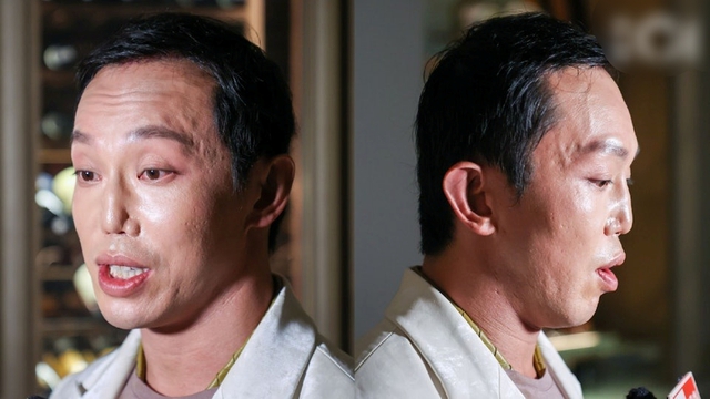 Gương mặt biến dạng sau tai nạn của Trần Bách Hy Gương mặt méo mó, biến dạng của Trần Bách Hy